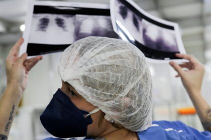 brasil-deve-ter-781-mil-novos-casos-de-cancer-por-ano-ate-2028