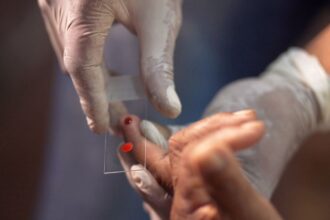 sus-comeca-a-usar-novo-tratamento-contra-a-malaria-em-criancas