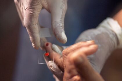 sus-comeca-a-usar-novo-tratamento-contra-a-malaria-em-criancas