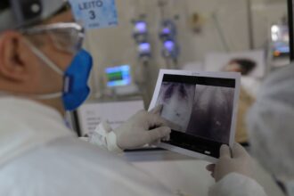 broncopneumonia:-entenda-quadro-que-causou-internacao-de-bolsonaro