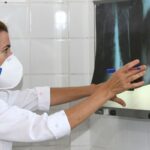oms-recomenda-testes-de-diagnostico-rapido-para-erradicar-tuberculose