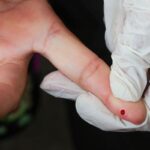 teste-rapido-de-dengue-passa-a-integrar-tabela-do-sus