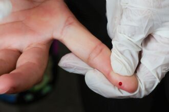 teste-rapido-de-dengue-passa-a-integrar-tabela-do-sus
