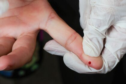 teste-rapido-de-dengue-passa-a-integrar-tabela-do-sus