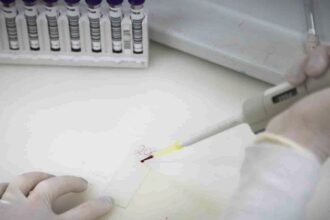 exames-descartam-ebola-em-imigrante-da-republica-democratica-do-congo